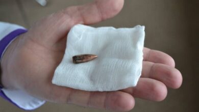 У Києві прооперували українського військового, який 3 роки провів у полоні росіян із кулею в серці (Відео)