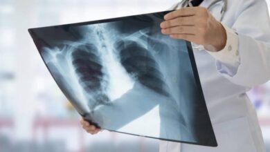 В Україні оновили методику діагностики туберкульозу: пробу Манту більше не робитимуть (Фото)